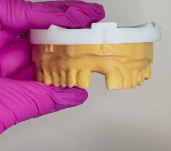 Affordable Semi-Flex Flipper (Up to 3 Adjacent Teeth) – Buy Online Best Dental Flippers | Flipper Tooth Cost, Benefits, Types