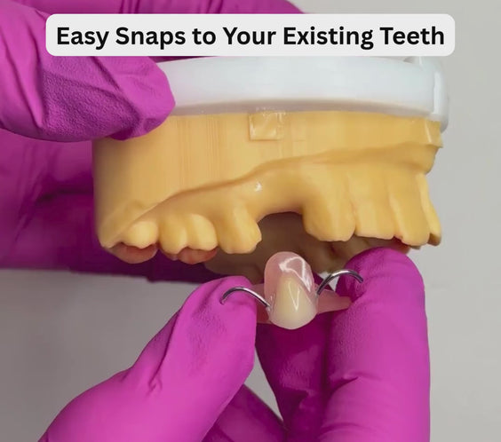Acrylic flipper snaps easily to your existing teeth