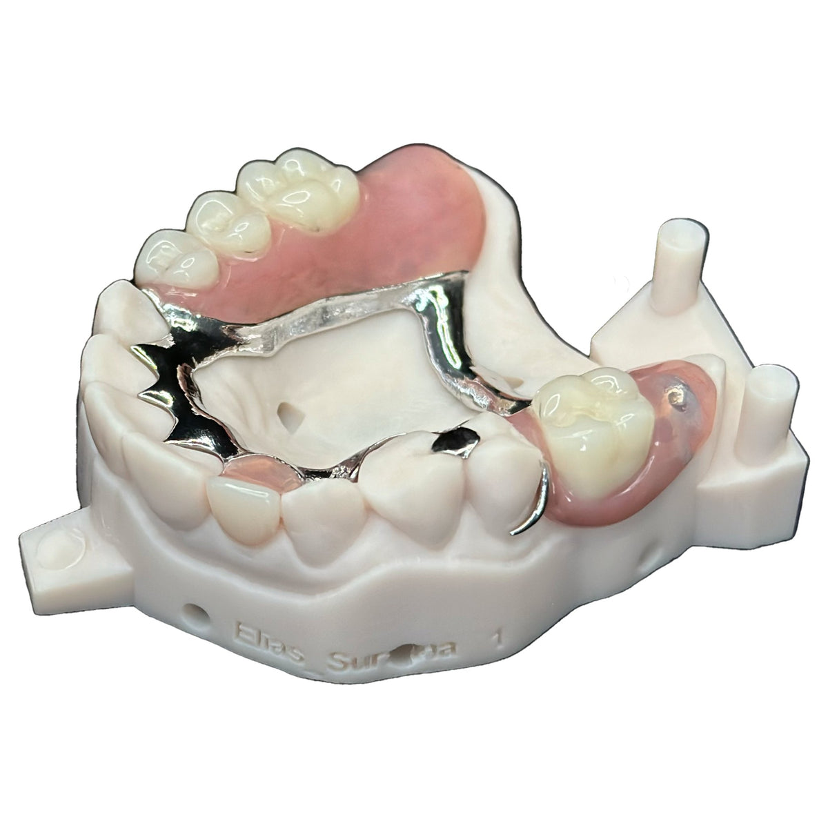 Metal Fpd OUR PRINTED METAL PARTIAL DENTURE