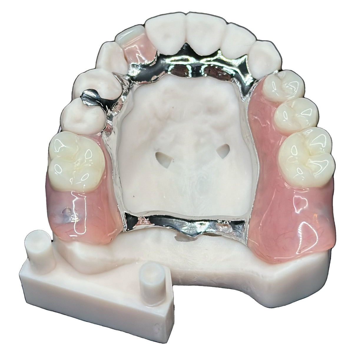 Rectangular Frame Teeth OUR PRINTED METAL PARTIAL DENTURE