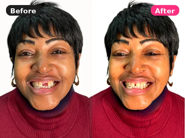 Before and after