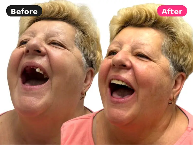 Before and after