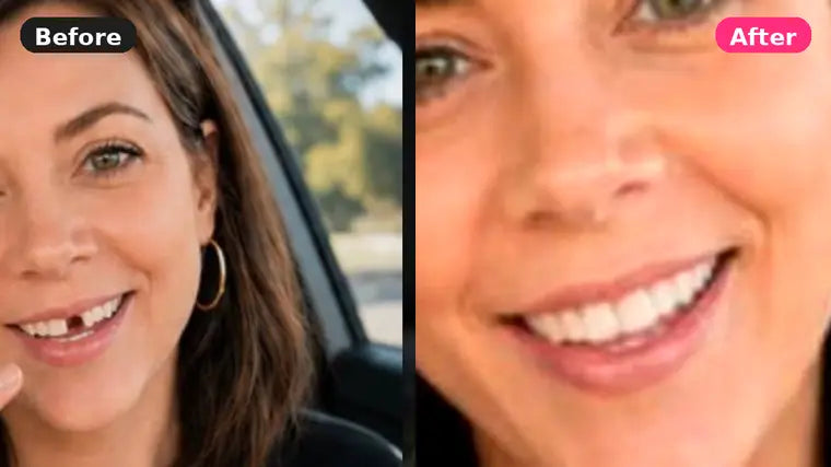 Before and after