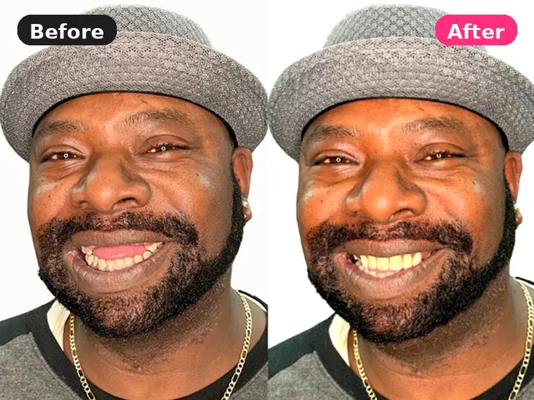 Before and after