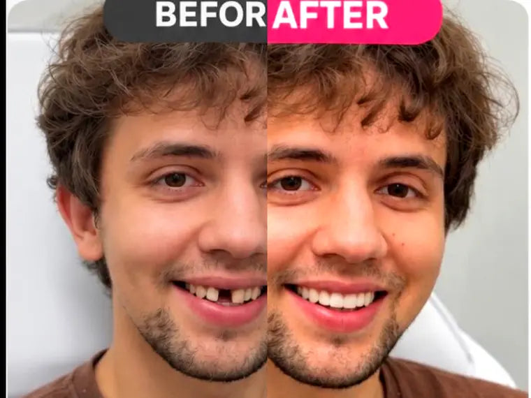 Before and after