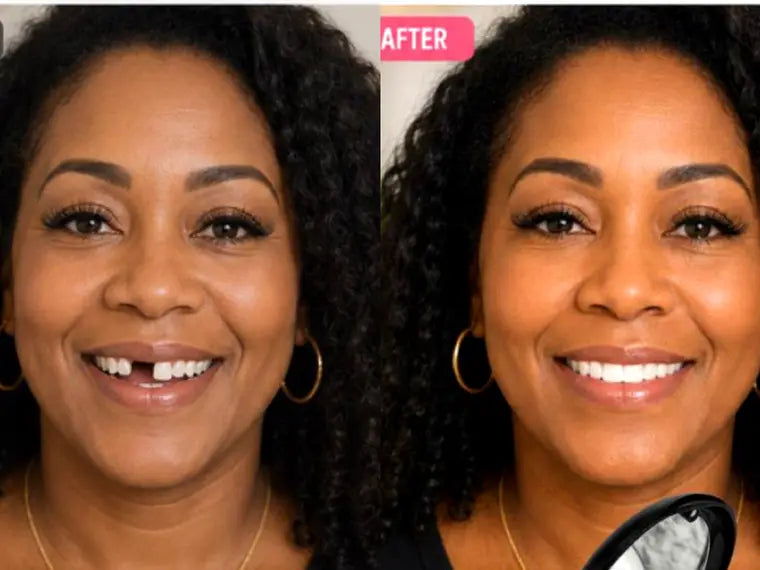 Before and after
