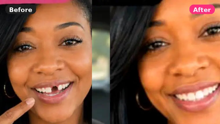 Before and after